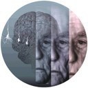 Sociedade portuguesa e doenças do envelhecimento: o Projecto Alzheimer
